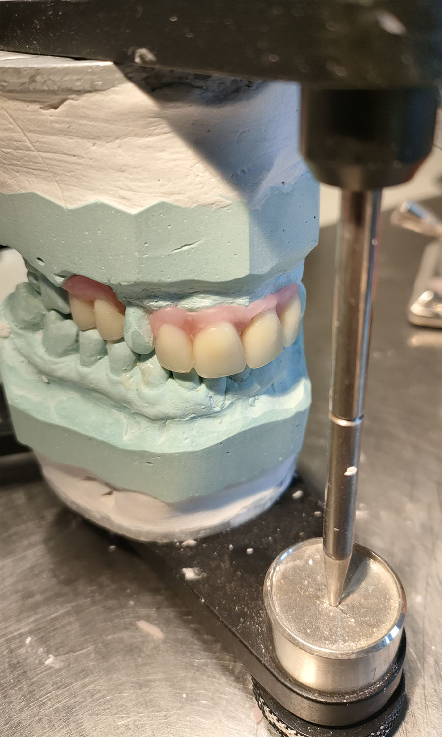 Montage sur articulateur